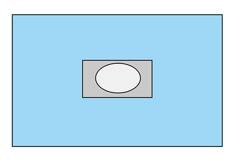 Campo Fenestración